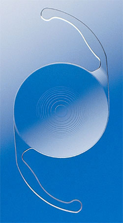 ReSTOR implant lens picture Dayton Ohio