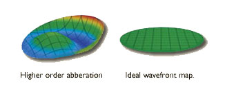 High definition vision achieved by correcting high order aberrations.